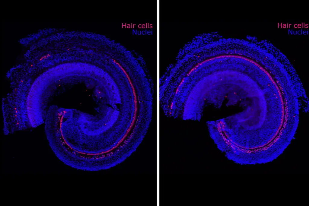 Regeneração celular das células ciliares, como visto na parte rosada, antes (à esquerda) e depois (à direita) (Imagem: Hinton A.S., Yang-Hood A. et al)