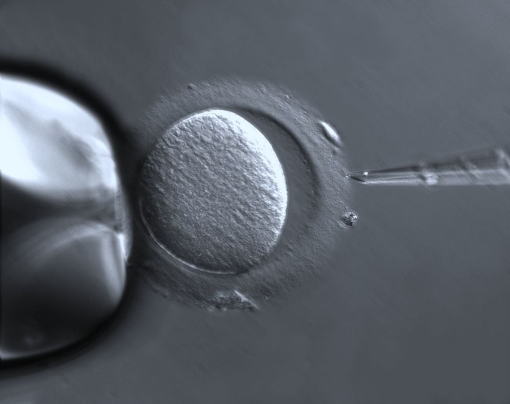A descoberta de que os espermatozoides continuam infectados após a alta do paciente deve ser levada em conta por clínicas de fertilização e casais que desejam uma concepção natural (Imagem: ZEISS Microscopy/CC-BY-2.0)