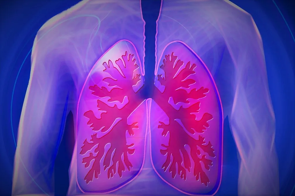 Estudando os brônquios de fumantes e não-fumantes, cientistas descobrem o que deixa alguns deles livres de câncer de pulmão (Imagem: Kalhh/Pixabay)