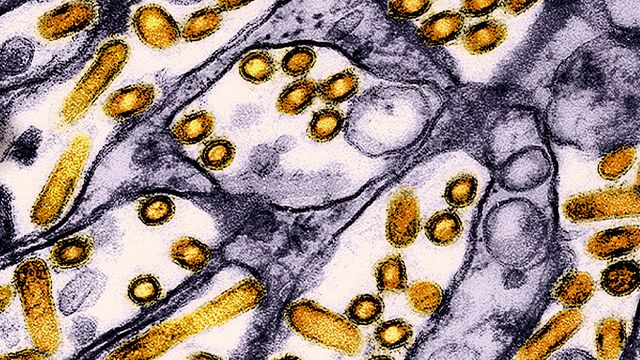 CDC/NIAID/Wikimedia Commons