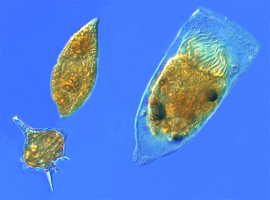 Plânctons podem ajudar no entendimento de como infecções acontecem (Imagem: Reprodução/Tintinnidguy/Wikimedia Commons)