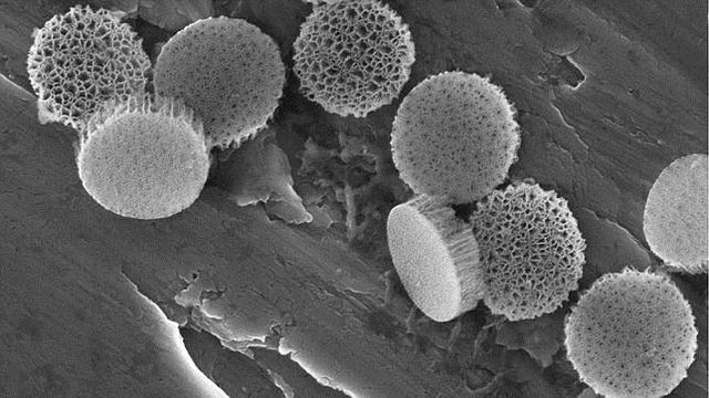 Cientistas descobrem como usar nanopartículas de silício para combater o câncer