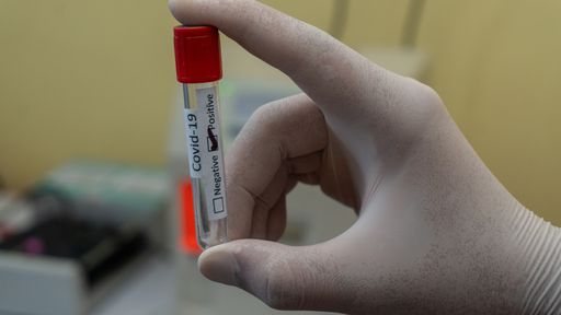 COVID-19: testes de antígenos podem ajudar na retomada da economia; entenda