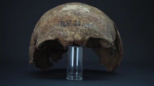 Bactéria da peste bubônica é encontrada em crânio de mais de cinco mil anos