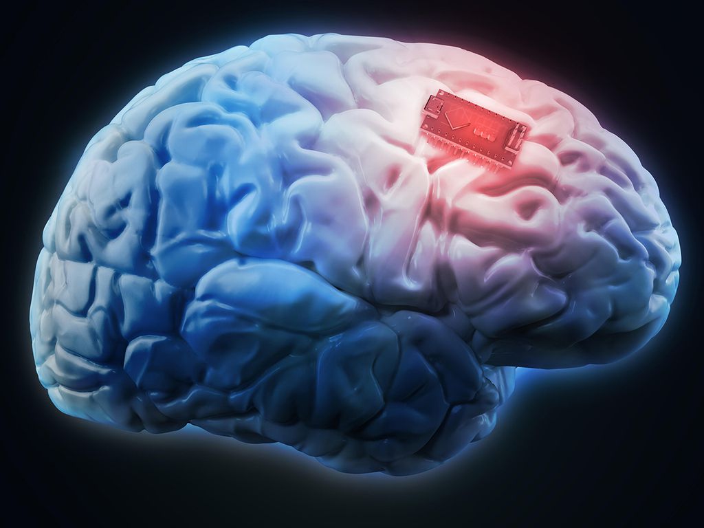 Implantes de memória já existem e podem se popularizar em duas décadas (Imagem ilustrativa/Shutterstock)