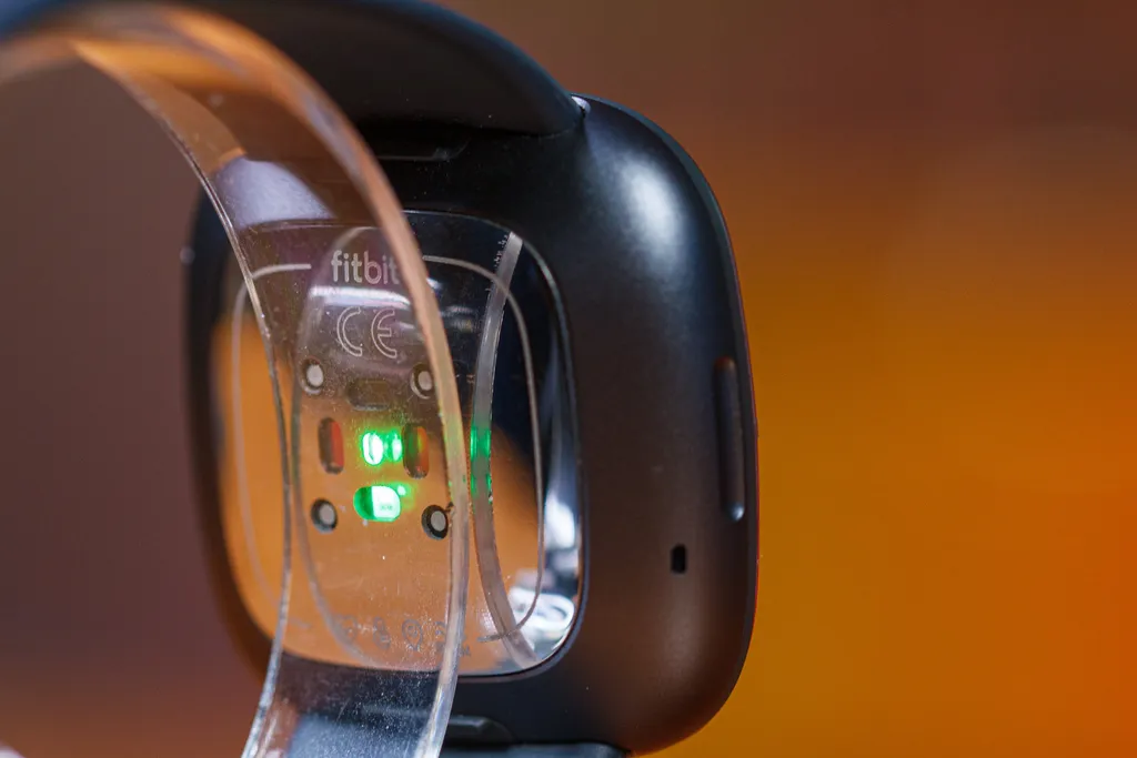 Kit de sensores do Fitbit Sense é completo (Imagem: Ivo Meneghel Jr./Canaltech)