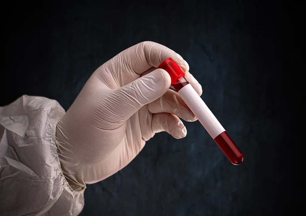 Exame de sangue pode apontar para inúmeras doenças, como anemia e até leucemia (Imagem: Reprodução/Grafvision/Envato)