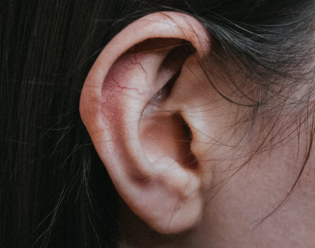 A composição da cera de ouvido, ou cerúmen, de cada pessoa depende de fatores corporais — em todos os casos, ela protege mais do que atrapalha (Imagem: Sam/Unsplash)
