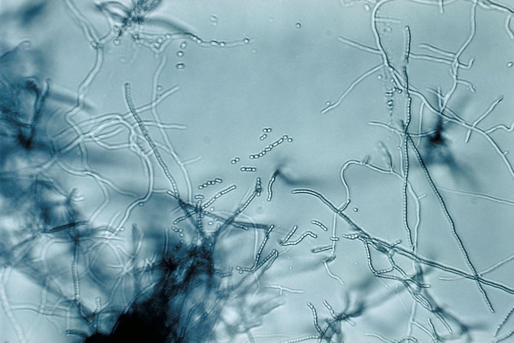 Bactérias do gênero Streptomyces produzem o inconfundível cheirinho de terra molhada depois da chuva (Imagem: Reprodução/ Wikipedia) 