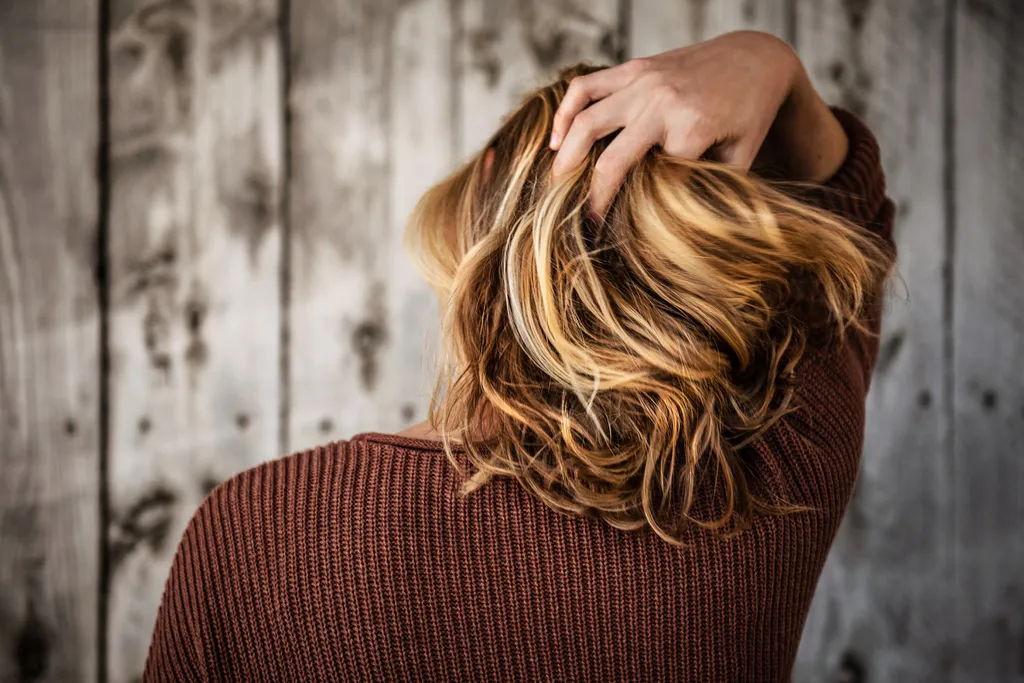 A caspa nos cabelos pode ter diversas causas (Imagem: Tim Mossholder/Unsplash)