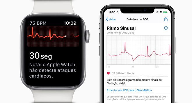Apple Watch detecta doença melhor que eletrocardiograma de centro médico alemão