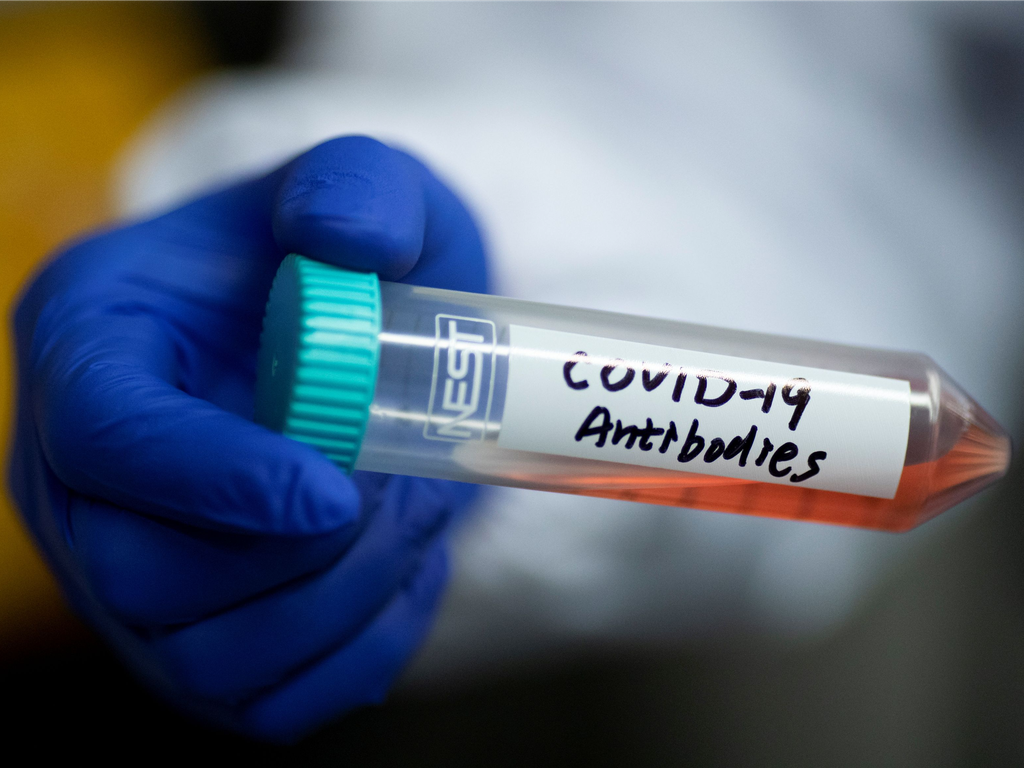 Laboratório dos EUA descobre anticorpo 100% eficaz em testes contra a COVID-19