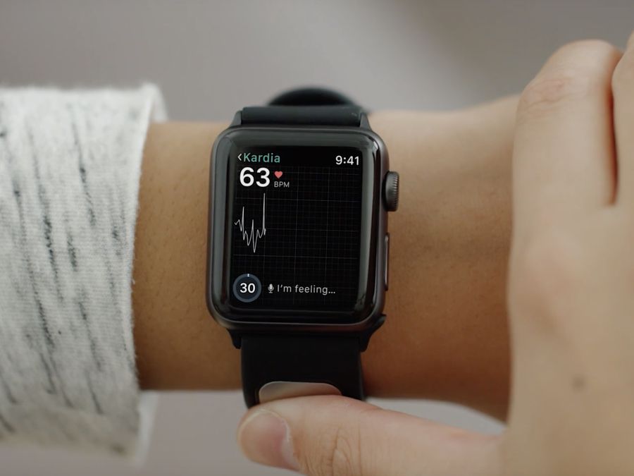 Apple Watch series3 故障 i326284.jpeg