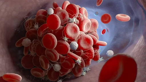 Covid aumenta em 33% o risco de um coágulo sanguíneo potencialmente fatal 