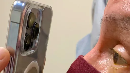 Médico descobre que Macro do iPhone 13 Pro ajuda a tratar seus pacientes