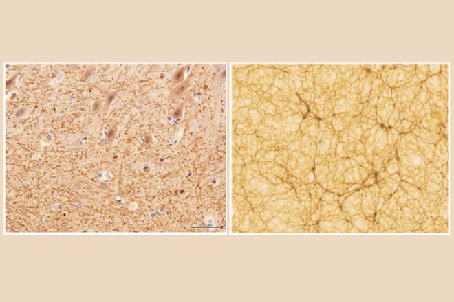À esquerda, uma imagem de secção do cerebelo obtida como microscopia eletrônica; à direita, uma secção de uma simulação cosmológica (Imagem: Reprodução/University of Bologne)