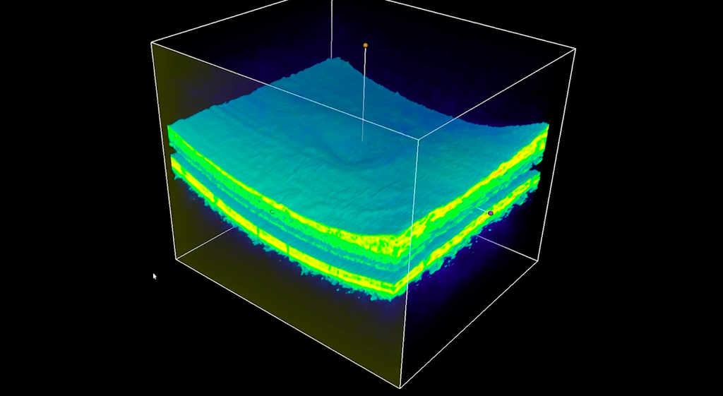 Captura de tela do escaneamento de tecidos da IA da DeepMind (Imagem: DeepMind)