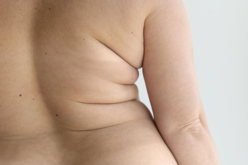 Variante genética pode tornar alguém mais suscetível à obesidade (Imagem: Freepik)