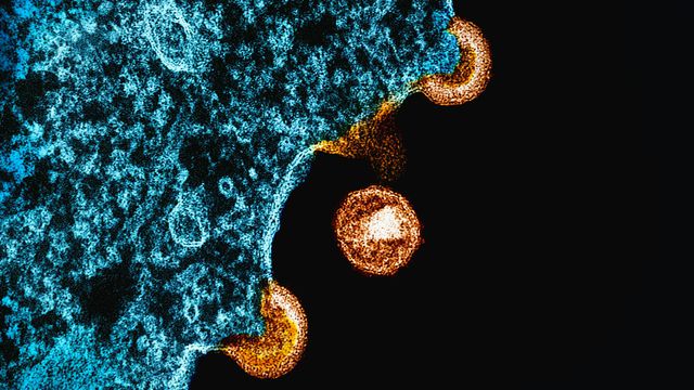 National Institute of Allergy and Infectious Diseases