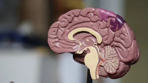 Cientistas analisam relação entre COVID-19 e distúrbios cerebrais