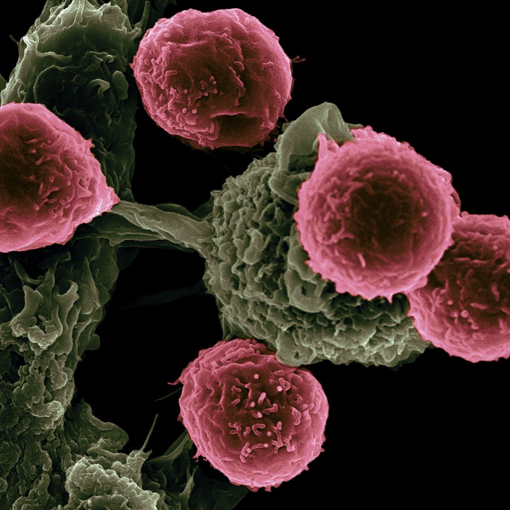 Infecção teria ativado o sistema imune a trabalhar intensamente, resultado na remissão da neoplasia (Imagem: National Cancer Institute/Unsplash)