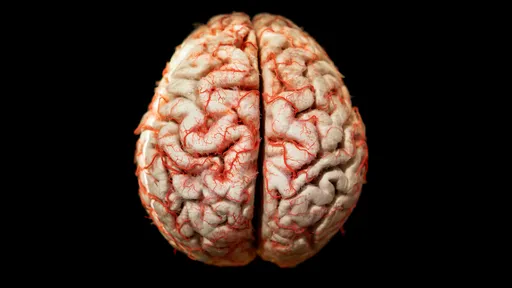 O cérebro é capaz de cicatrizar sozinho?