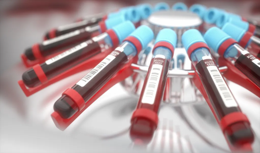Através de exames de sangue, é possível saber quais anticorpos estão em circulação no sangue (Imagem: Ktsimage/Envato)