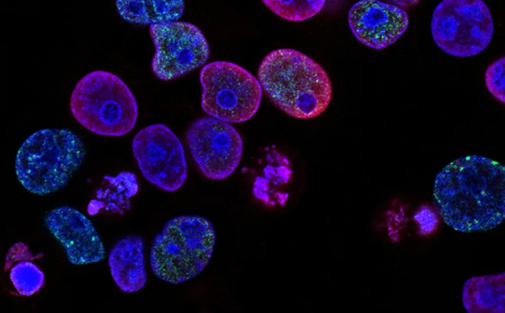 Vírus geneticamente modificado consegue combater o câncer avançado de pâncreas (Imagem: National Cancer Institute/Unsplash)