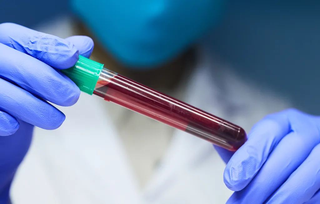 Em fase de testes, novo exame de sangue pode revelar se uma pessoa tem diabetes antes dos sintomas iniciais (Imagem: Seventyfourimages/Envato)
