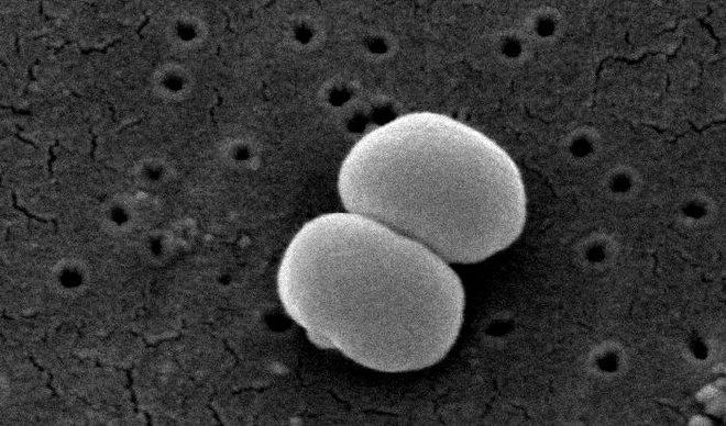 Staphylococcus epidermidis, um dos micróbios encontrados na orelha (Imagem: Janice Carr/Wikimedia Commons)