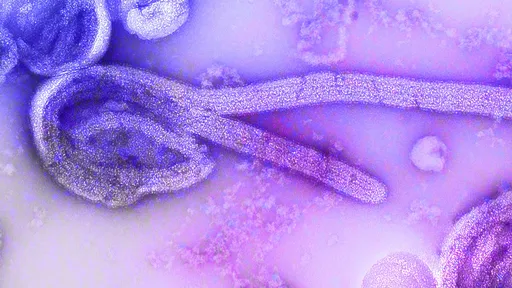 Ebola pode se esconder no cérebro e causar recaída "mortal" no futuro