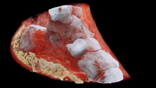 Equipamento é capaz de tirar radiografias coloridas de corpos humanos