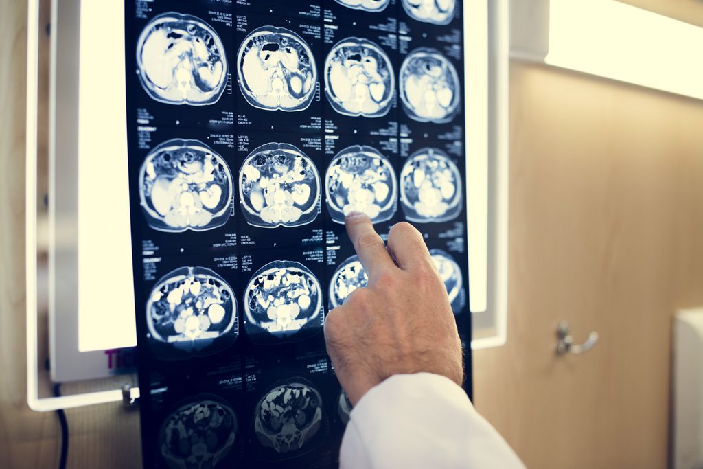 Após analisar milhares de ressonâncias magnéticas, cientistas revelam que o cérebro humano está ficando maior (Imagem: Rawpixel/Envato)