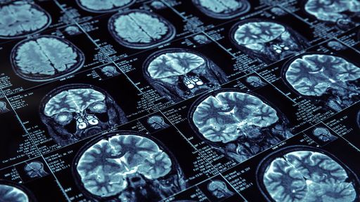 Neurossensores do tamanho de um grão de sal prometem restaurar danos cerebrais