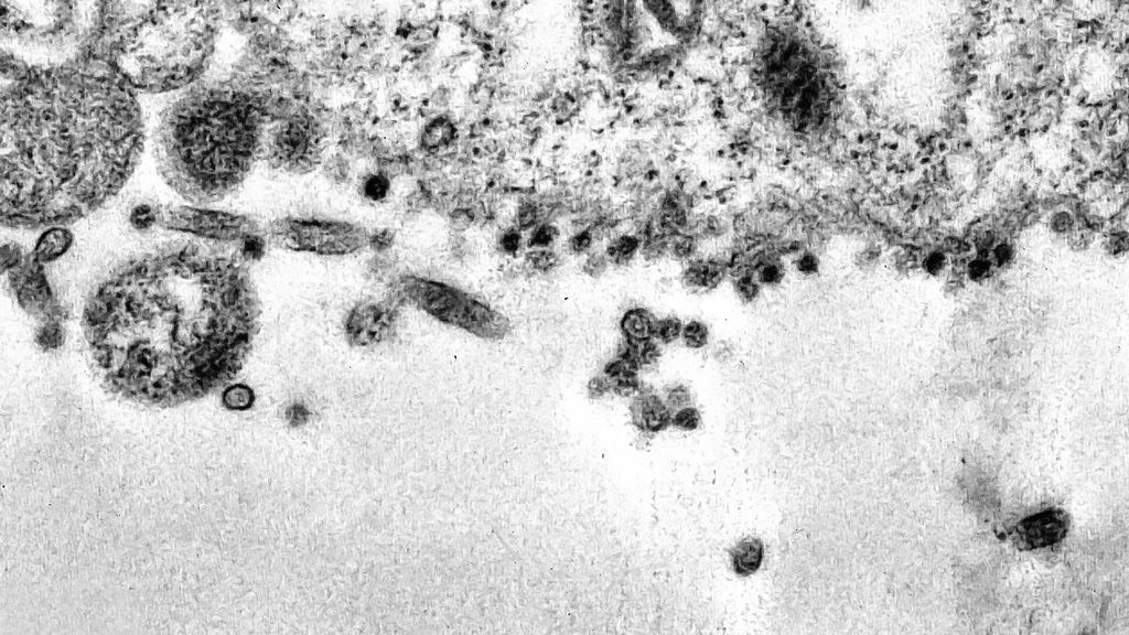 Pesquisadores da Fiocruz registram processo de infecção de uma célula pelo coronavírus. Os pontos pretos são coronavírus, muito menores que a célula hospedeira, chegando à membrana celular e se aderindo nela (Imagem: Débora F. Barreto-Vieira/IOC/Fiocruz)