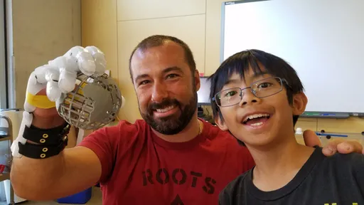 Garoto de 9 anos cria mão robótica usando impressão 3D