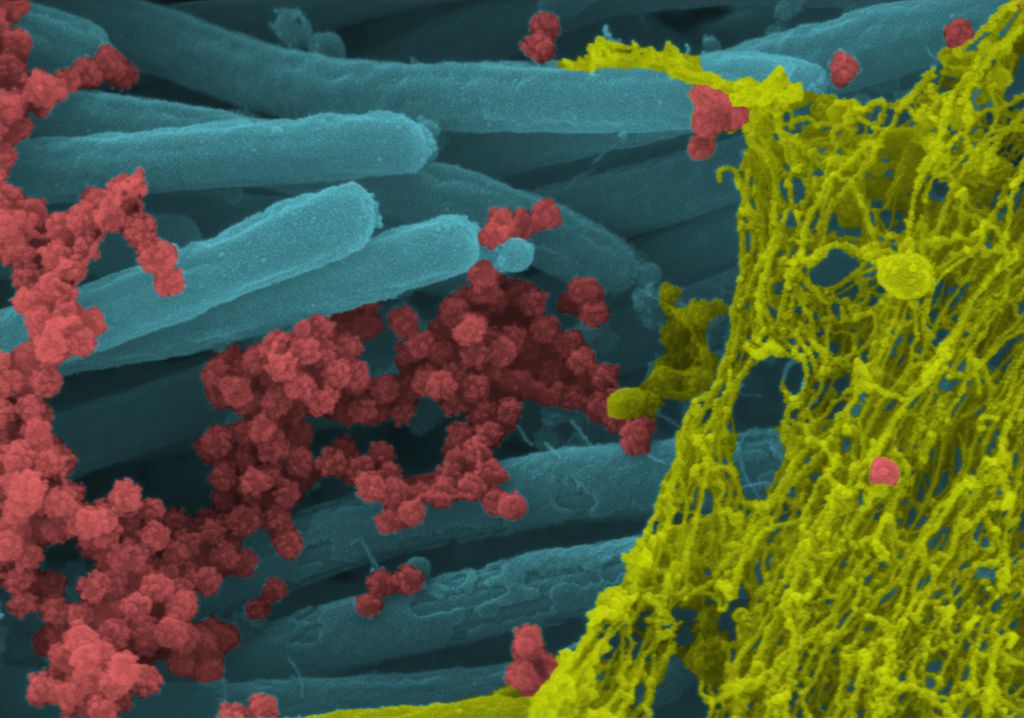 Novas imagens detalham o momento de infecção de uma célula pelo coronavírus (Imagem: Reprodução/Ehre Lab/UNC School of Medicine)