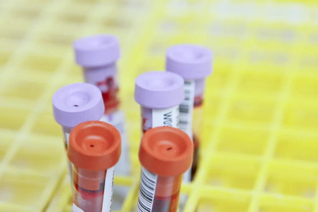 Cientistas criam novo exame de sangue para detectar câncer de próstata (Imagem: National Cancer Institute/Unsplash)