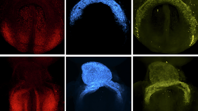 Abukar et al, 2025/EMBO Journal